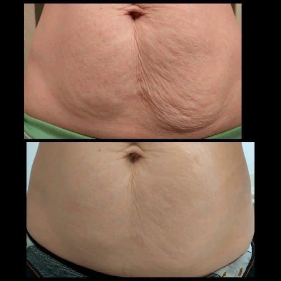 CandelBurn – Crema Reductora Quema-Grasa + Guia de masajes linfaticos 🔥