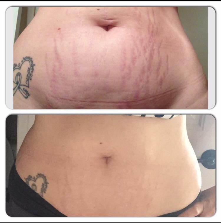 CandelBurn – Crema Reductora Quema-Grasa + Guia de masajes linfaticos 🔥