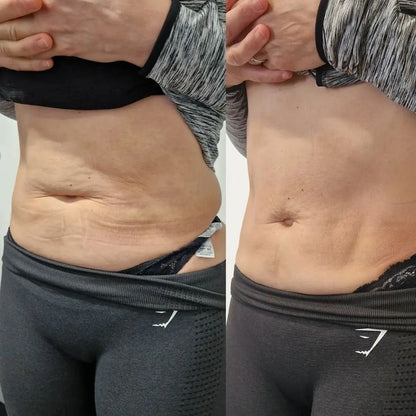 CandelBurn – Crema Reductora Quema-Grasa + Guia de masajes linfaticos 🔥